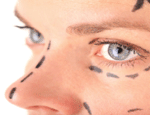 The Average Cost of Cosmetic Surgeries