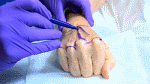 Peacocking - Male Cosmetic Surgery On The Rise